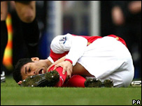 Arsenal's Eduardo with his broken leg