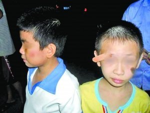 8岁学生称遭老师掌掴眉角开裂皮肉外翻(图) _新浪教育_新浪网