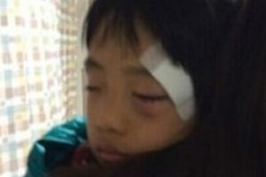 费曼撞伤眼角缝5针 检查2次视力仍模糊