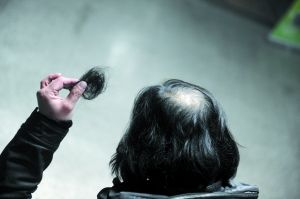 司机刘师傅自称被人揪下头发