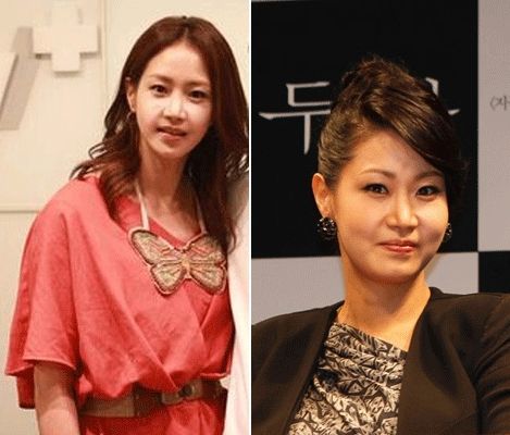 23】女星申恩庆整容照曝光 削骨手术变锥子脸