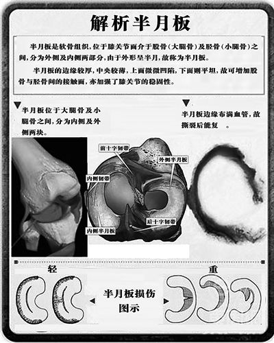 "脚踏实地"保护半月板