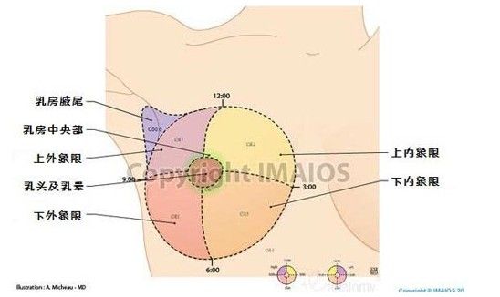 乳房的解剖图腋窝淋巴结与乳腺癌流言还声称几乎所有的乳腺癌都是发生