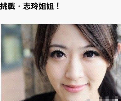 手術后網友Hanna的臉型獲得有效地改善 手術后網友Hanna的臉型得到有效地改善