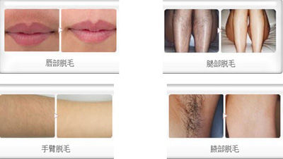 学生求职整形八大热门项目 成功“加分”