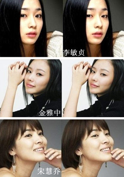 双眼皮重要吗 韩国明星告诉你