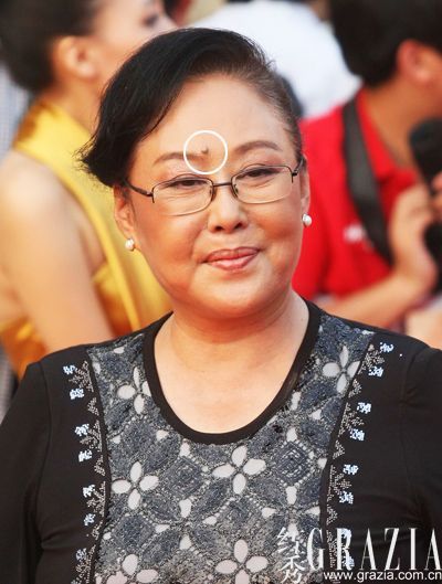 旺夫老婆痣
