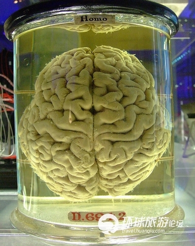 Human brain specimens of genuine goods at a fair price