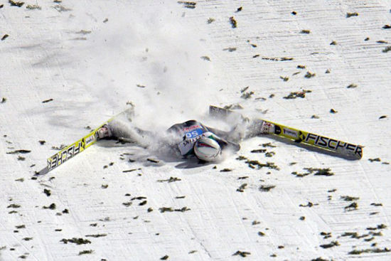 着陆时滑雪板突然侧翻,阿曼头部朝下摔倒在雪地上.