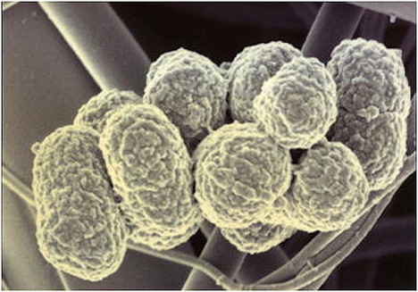 卟啉单胞菌属图片