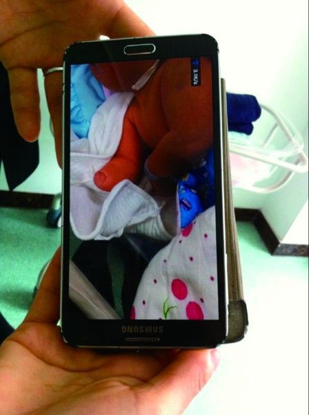 男婴产检正常出生却无右手官方称产检不含手足