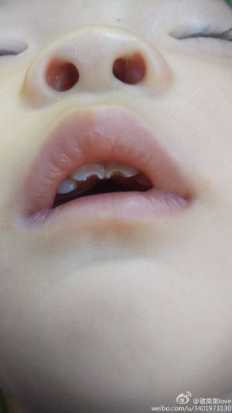 朱医生宝宝五个月,上个月牙根已经长了,最近发现他可能牙根痒,不停的