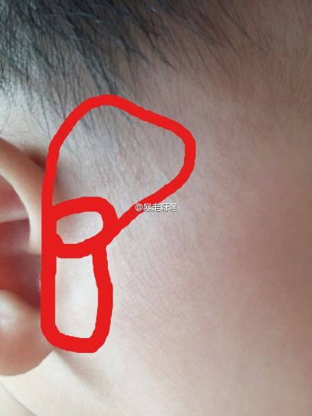 专家问答育儿专家鲍秀兰答宝宝吃喝拉撒那些事七