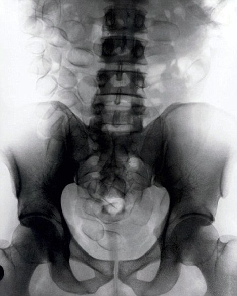 尼日利亚一毒贩吞下67包毒品 被英国海关查获
