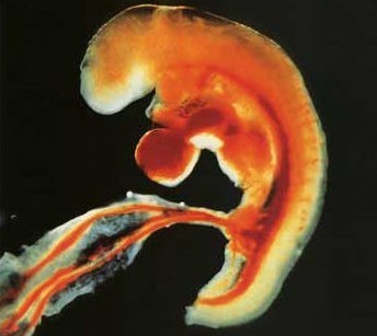 怀孕第5周胎儿图