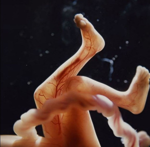 怀孕一个月胎儿有多大图片