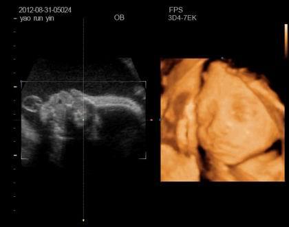 怀孕七个月胎儿图图片