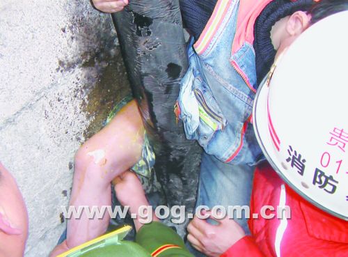 图文小孩大腿卡在缝隙中浇入菜油卡口松动了