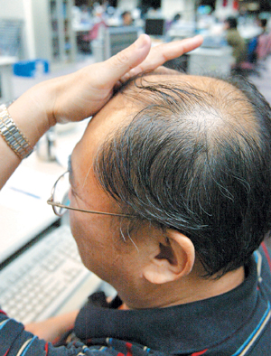 台秃男喝四物汤后顶上生细毛 秃男,生细毛