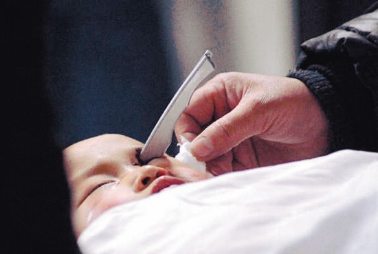 4岁男童钢刀插眼