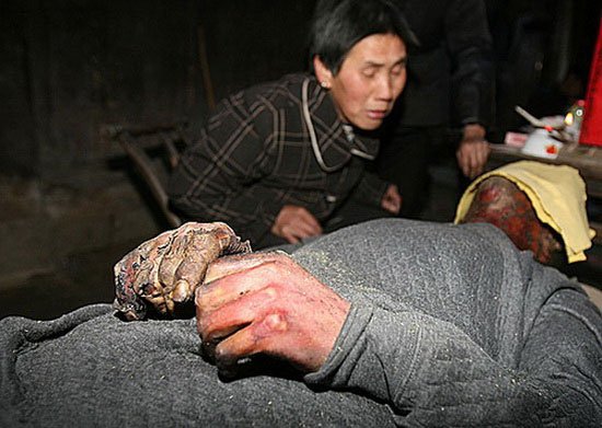 图文:村民在山火发生过程中不幸身亡
