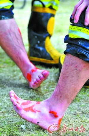 消防员受伤的脚图片
