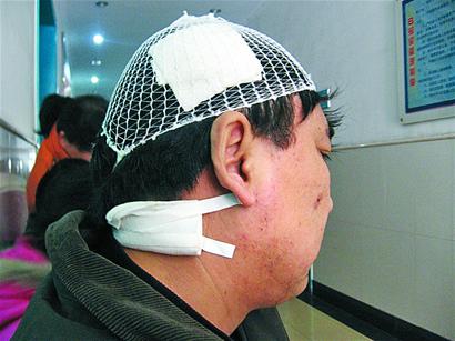 白先生很受伤   黄智义摄   时报3月3日讯(记者黄智义 实习生 张潇