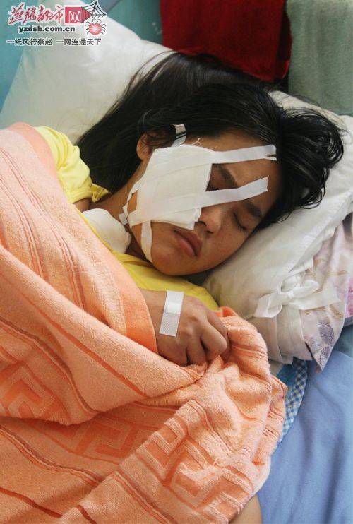 河北故城一村干部挥刀砍伤村民 耳朵被咬下一半