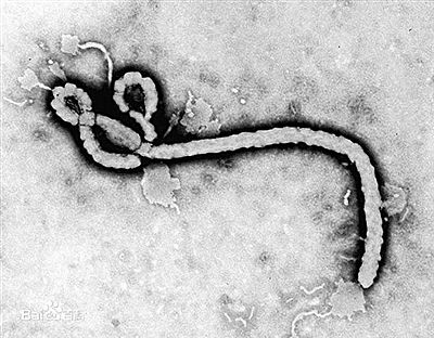 埃博拉病毒法制晚报讯(记者 王硕 武文娟)北京新排除一例埃博拉出血热