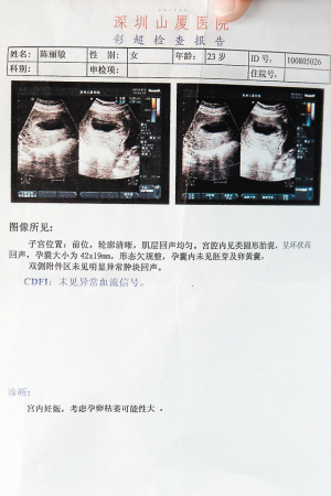 怀孕证明图片样本图片