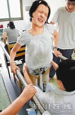 北川地震中截肢女孩康复后重返校园(组图)