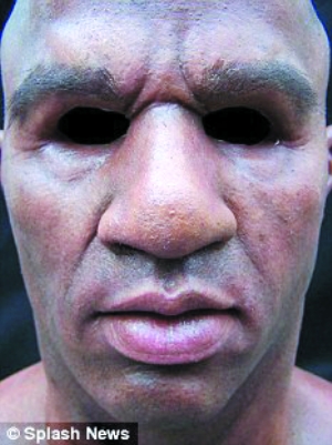 当地电视台给他取的绰号是"秃头强盗",因为他戴上面具后看起来是秃的