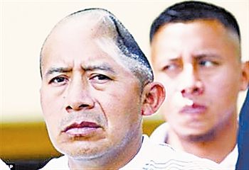 被警棍"削"掉"半个头"