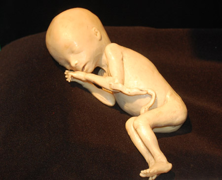 怀孕15周胎儿多大图片图片
