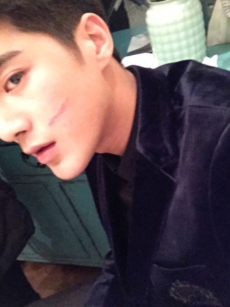 姜潮拍戏起冲突受伤自拍搞怪变鼻孔哥