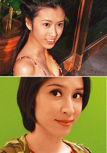 肉毒素玻尿酸现场版陈思齐15分钟变高鼻