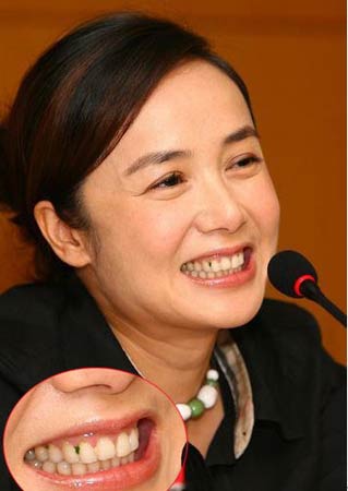 网友曝料:明星黄牙时刻有多尴尬(组图)(2)_新浪女性_新浪网