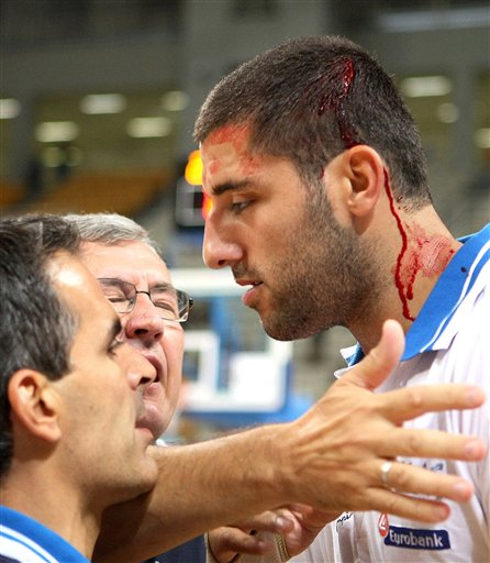 图文热身赛希腊塞尔维亚火爆武斗头破血流